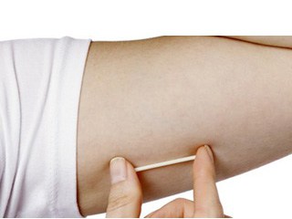 What Are The Benefits Of The Nexplanon Implant