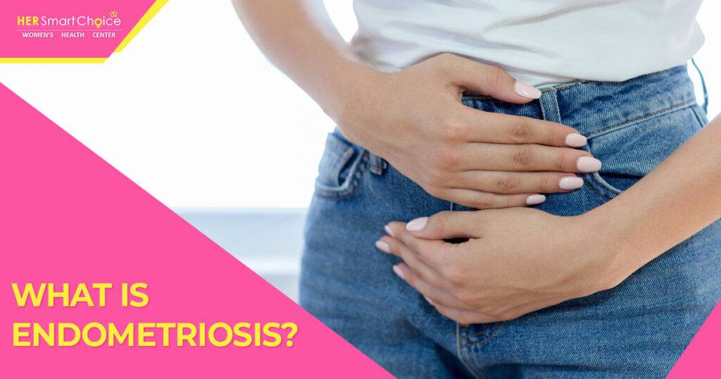 Endometriosis