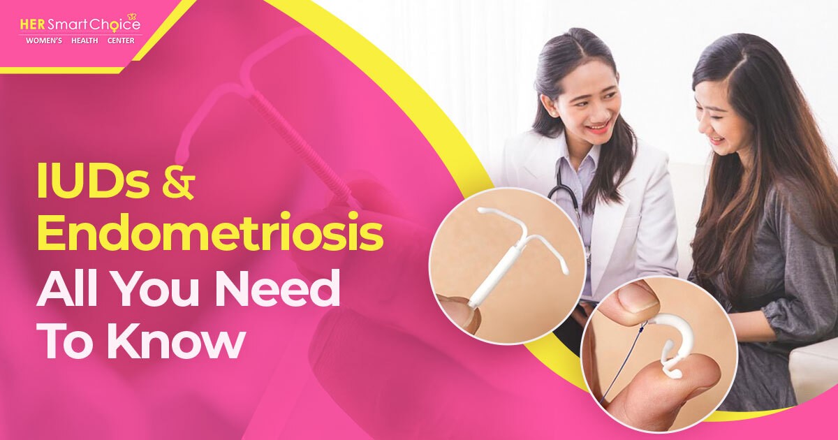 IUDs and endometriosis