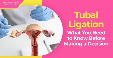 Tubal Ligation birth control
